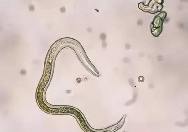 Fish parasites